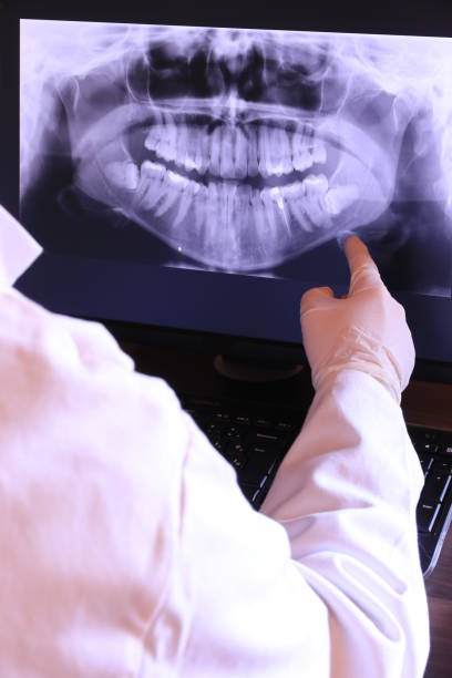 Best Emergency Root Canal Treatment in Granite Falls, MN